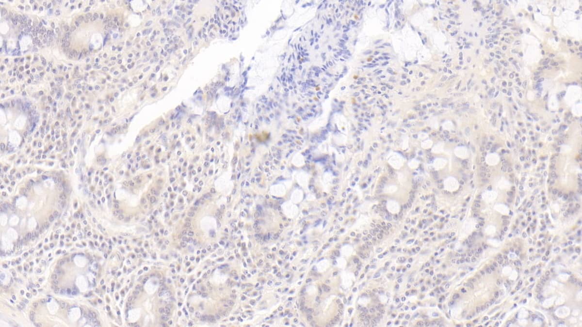 OAS1 Antibody (C14)