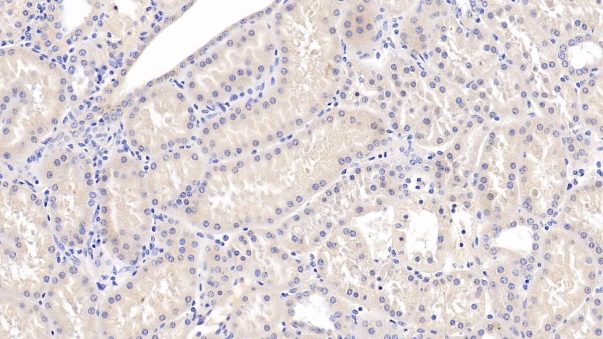 SLC12A3 Antibody (C5)