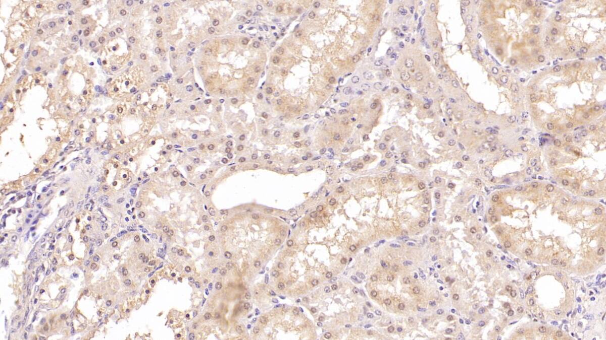 SLC12A3 Antibody (C7)