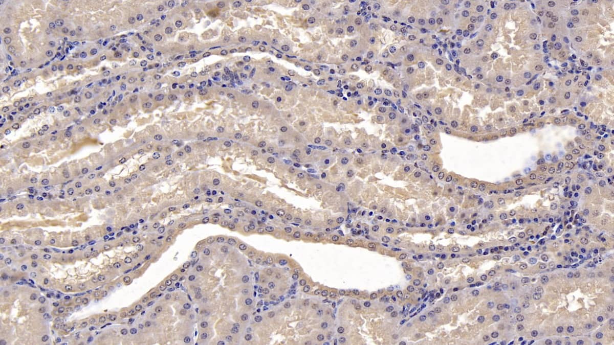 SLC12A3 Antibody (C9)