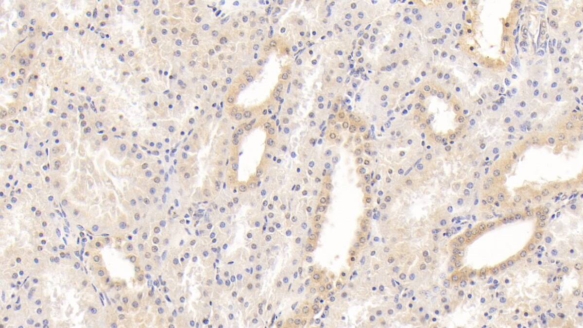 Laminin alpha 3 Antibody (C1)