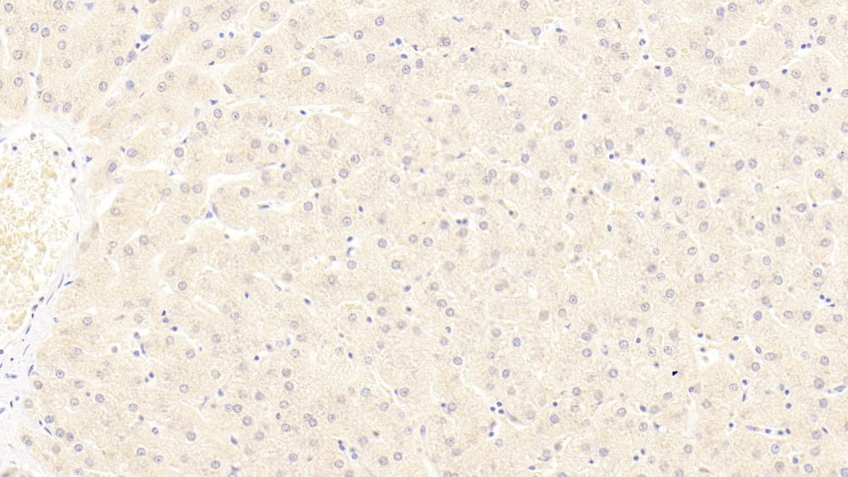 LRP-6 Antibody (C4)