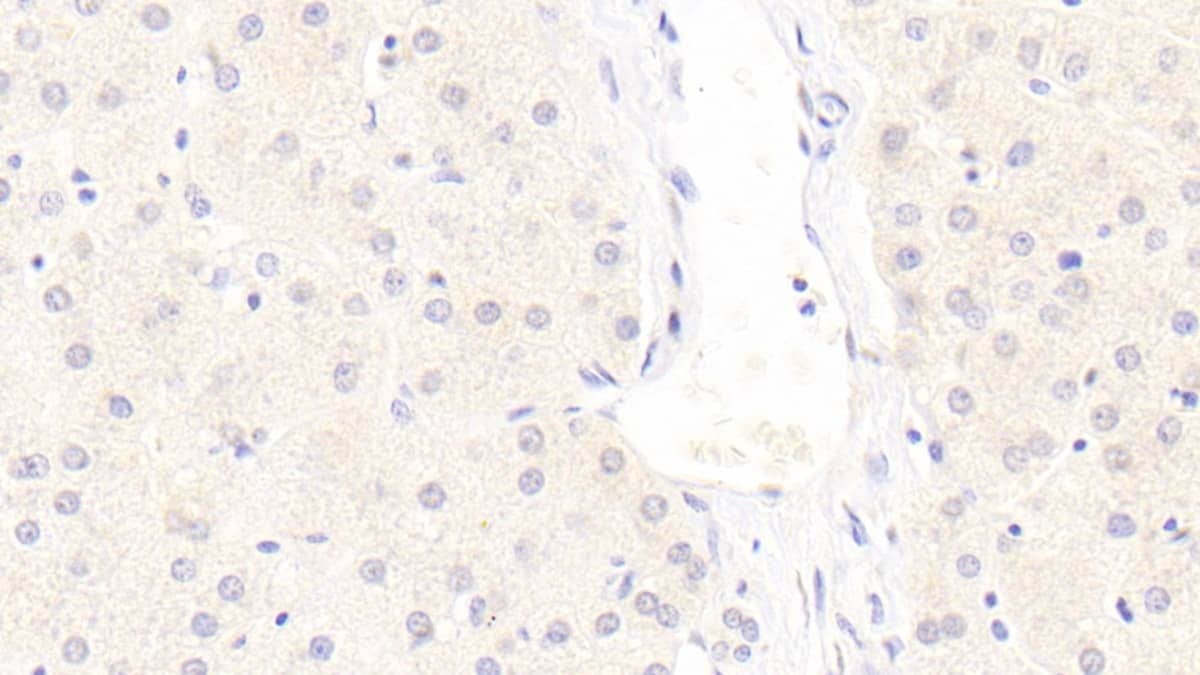 LRP-6 Antibody (C7)