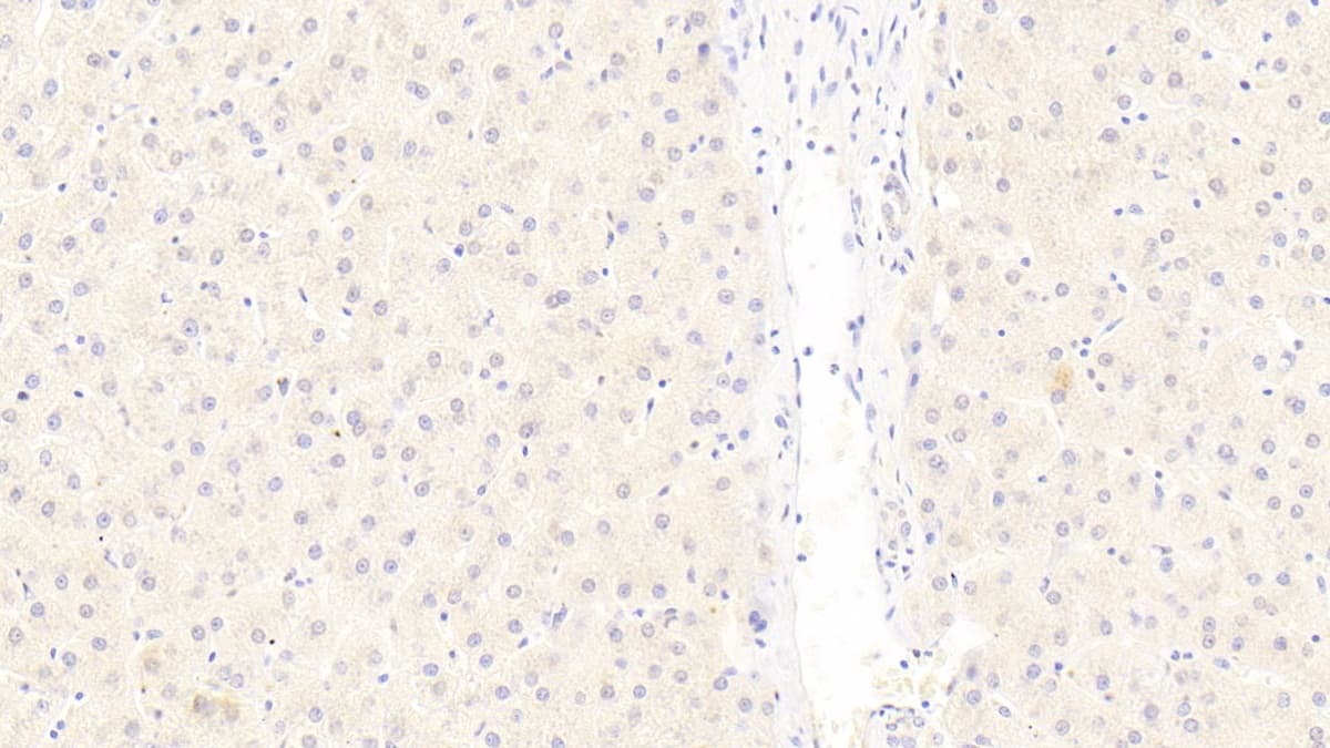 LRP-6 Antibody (C9)