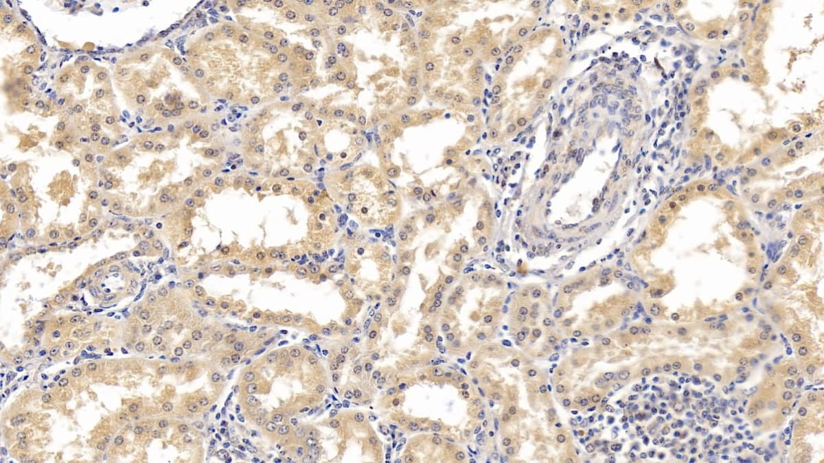 IFN-alpha F/IFNA21 Antibody (C7)