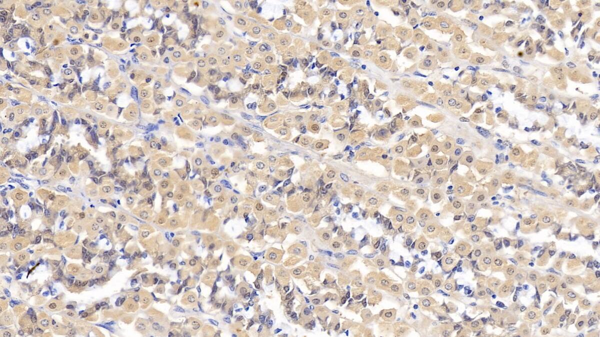 IFN-alpha F/IFNA21 Antibody (C7)