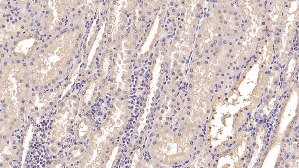 IFN-alpha F/IFNA21 Antibody (C2)