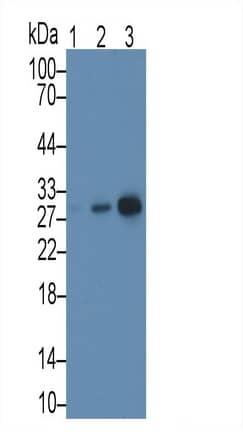 MAPRE1 Antibody (C5)