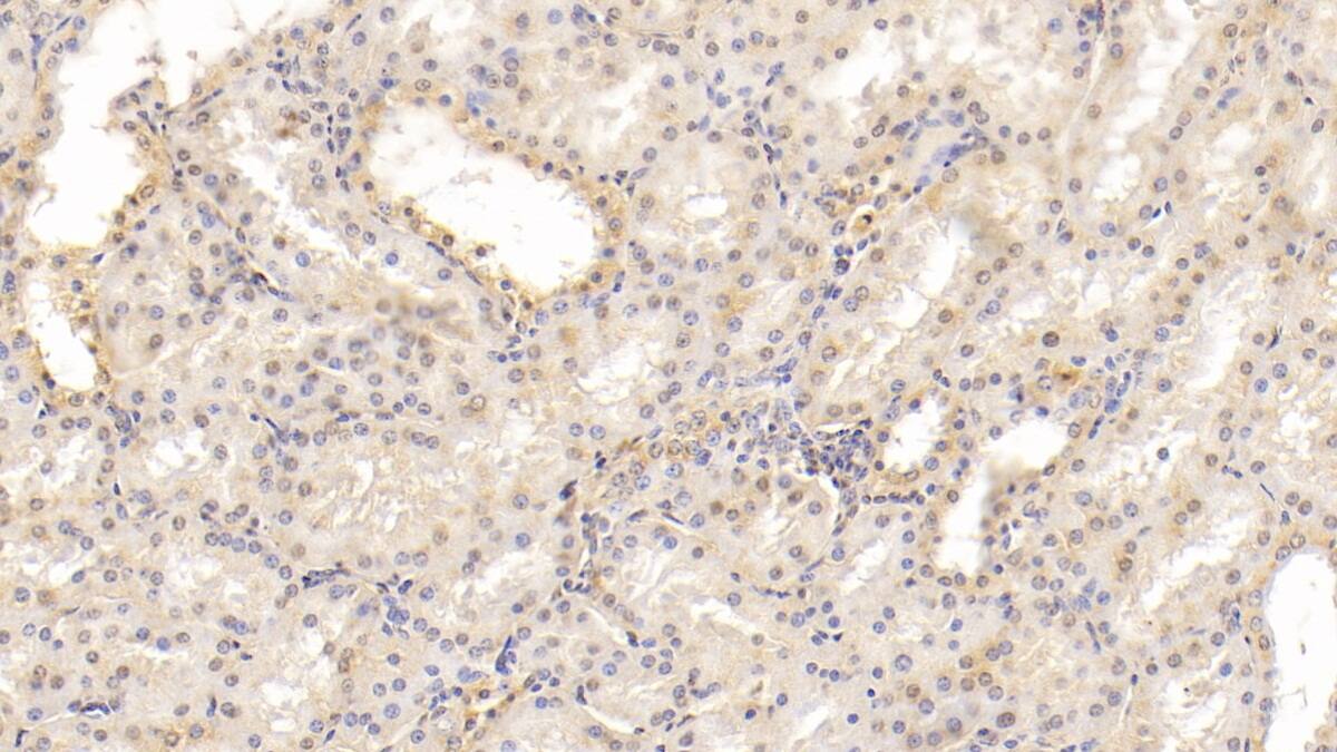 MAPRE1 Antibody (C5)