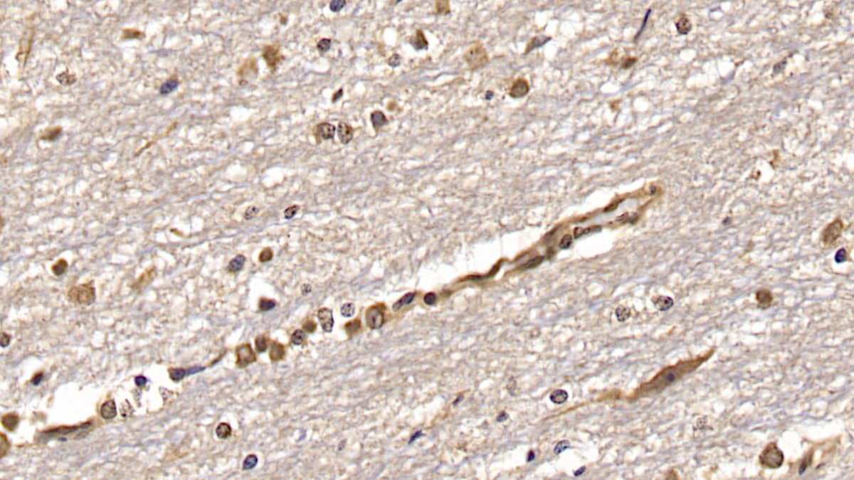 OAS2 Antibody (C5)