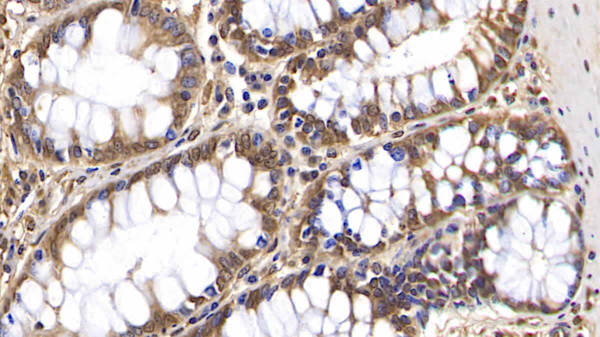 OAS2 Antibody (C5)