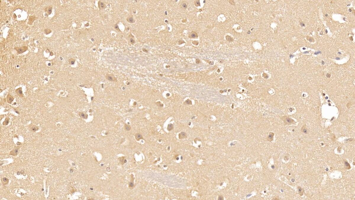 Casein Kinase 1 delta Antibody (C1)