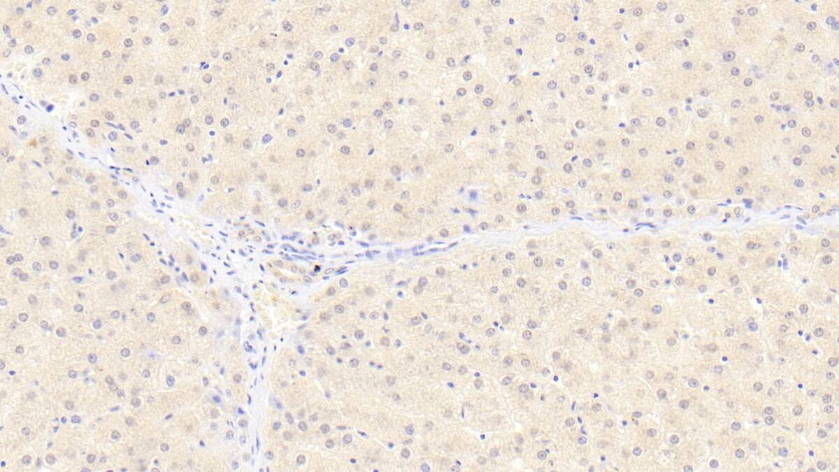 TTC11 Antibody (D3)