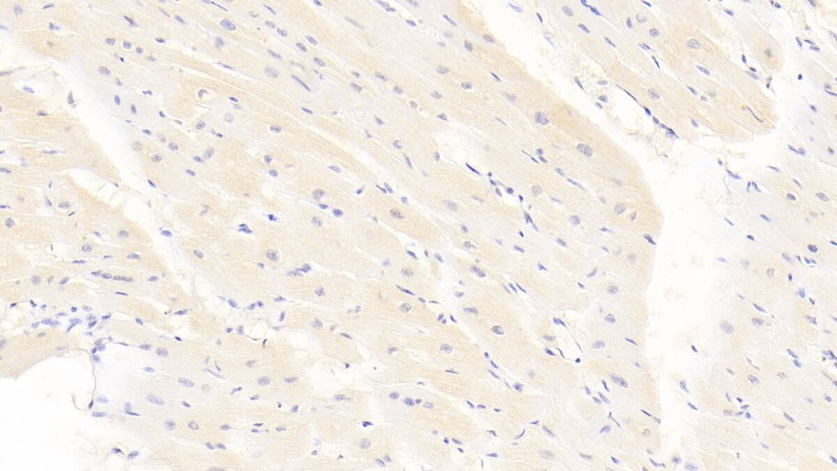 Calponin 2 Antibody (C15)