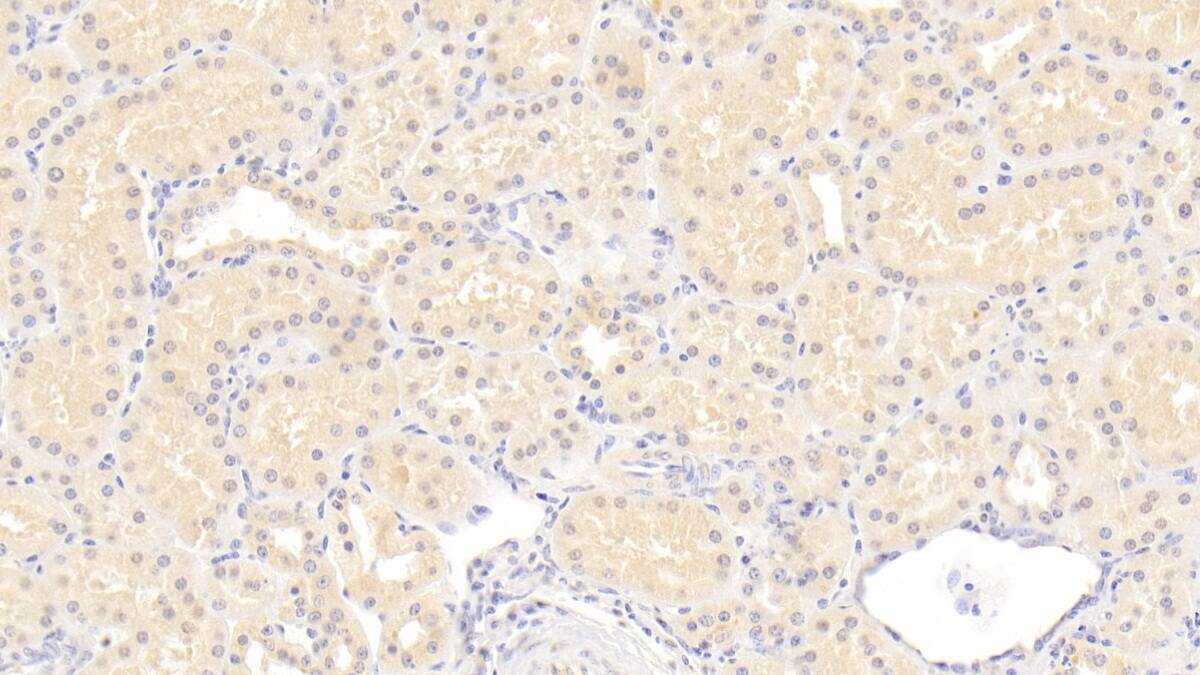 ISLR Antibody (C11)