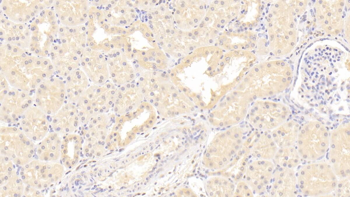 ISLR Antibody (C5)