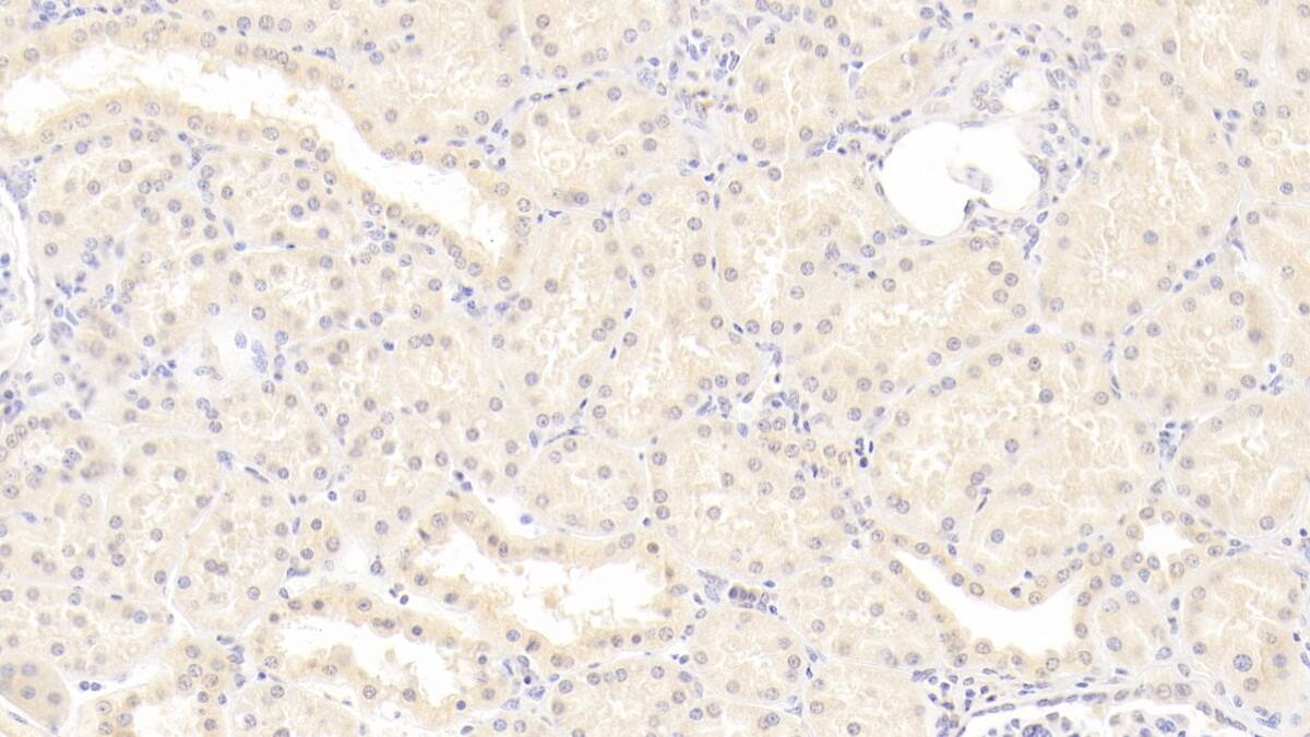 ISLR Antibody (C9)