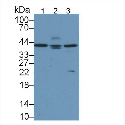 Apolipoprotein L2 Antibody (C8)