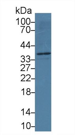 Apolipoprotein L2 Antibody (C4)