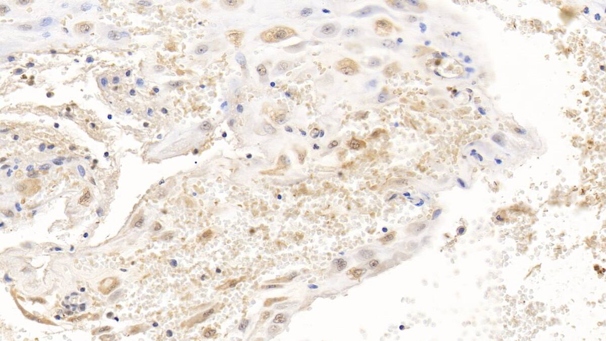 Apolipoprotein L2 Antibody (C3)