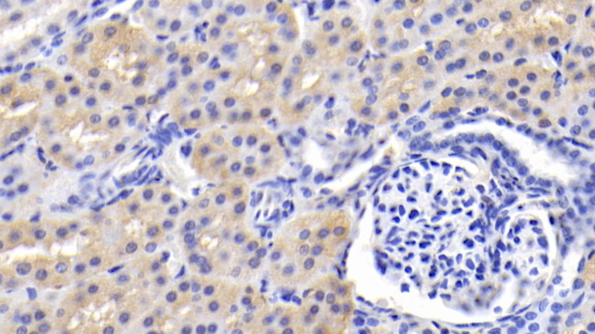 BAI3 Antibody (C3)