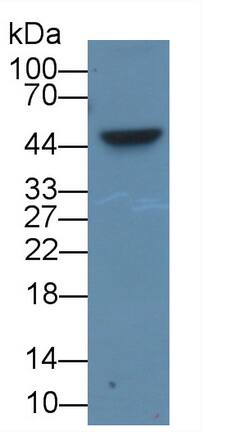 TDO2 Antibody (C5)