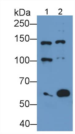 NMDAR2D Antibody (D5)