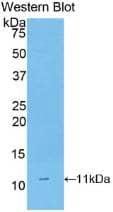 CD3 delta Antibody (2#)