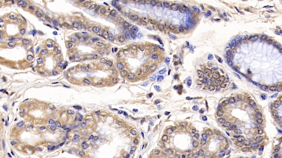 IL-29/IFN-lambda 1 Antibody (C11)