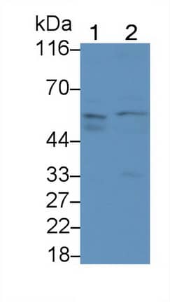 Activin RIIA Antibody (C5)