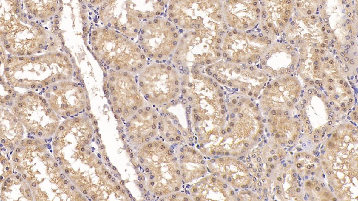 Activin RIIA Antibody (C1)
