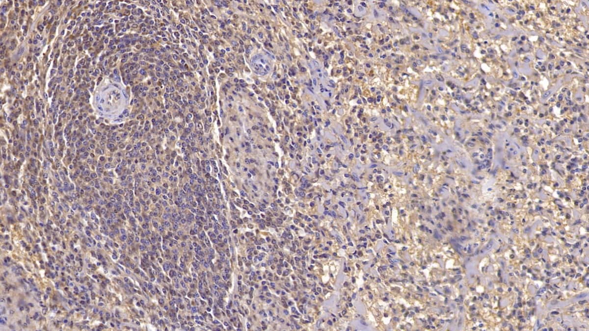 Activin RIIA Antibody (C1)