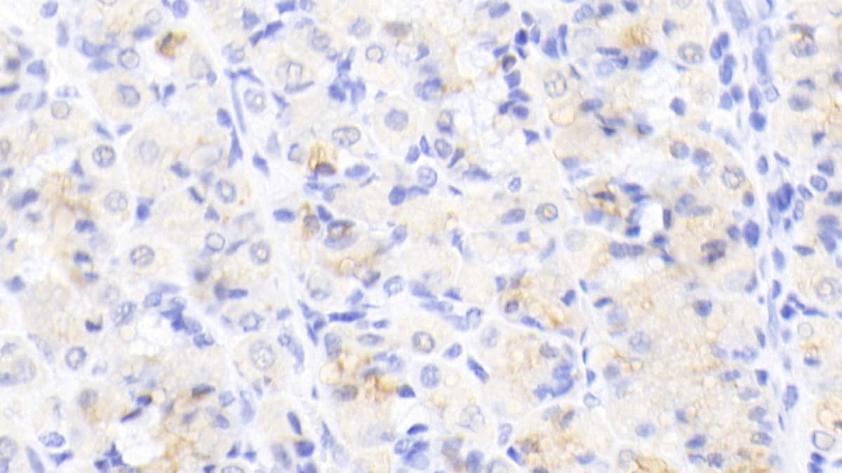 Activin RIIA Antibody (C7)