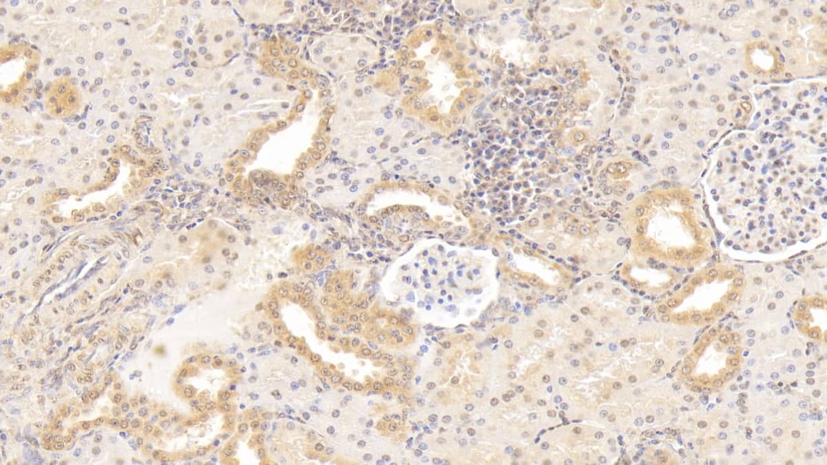 Gremlin 1 Antibody (D6)