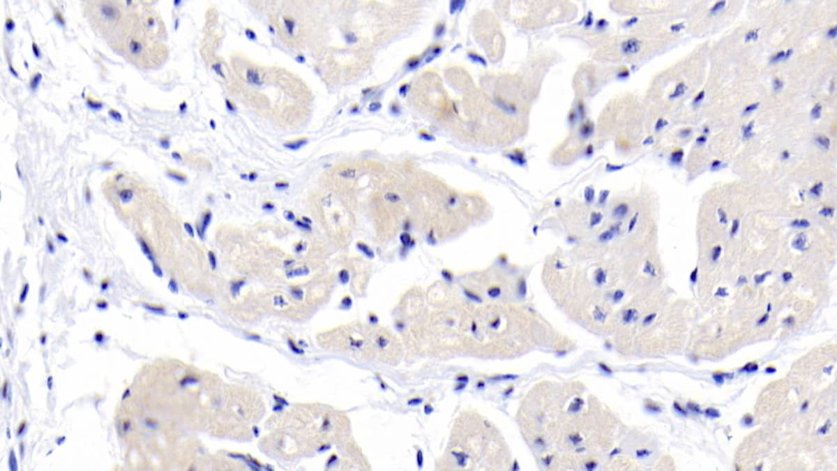 MYH7 Antibody (C3)