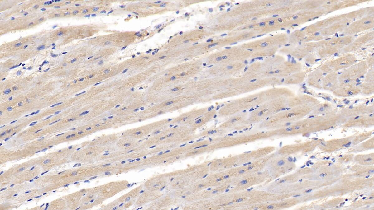 Lipolysis Stimulated Lipoprotein Receptor Antibody (C10)