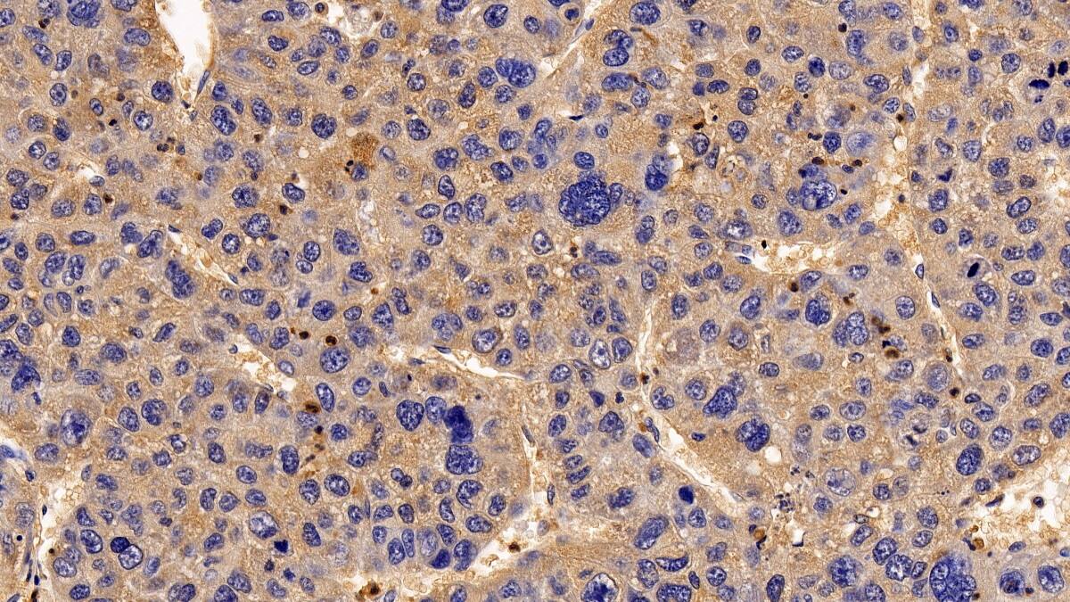 RGS19 Antibody