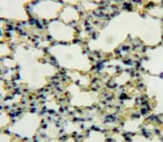 DEFB119 Antibody