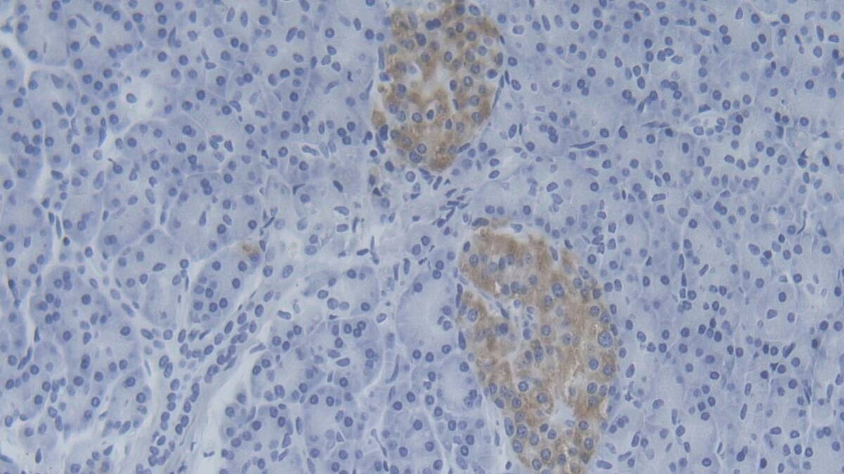 NMES1 Antibody