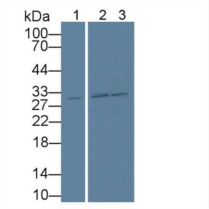 WDR90 Antibody