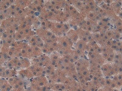 LRP5L Antibody