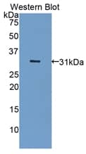 LRP5L Antibody