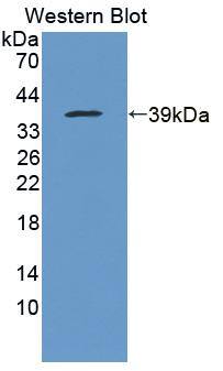 USP6NL Antibody