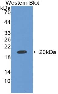 RBM20 Antibody