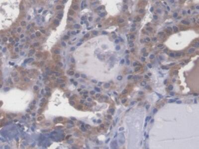 ECRG4 Antibody