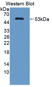 COQ10B Antibody