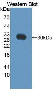 ABCC10 Antibody