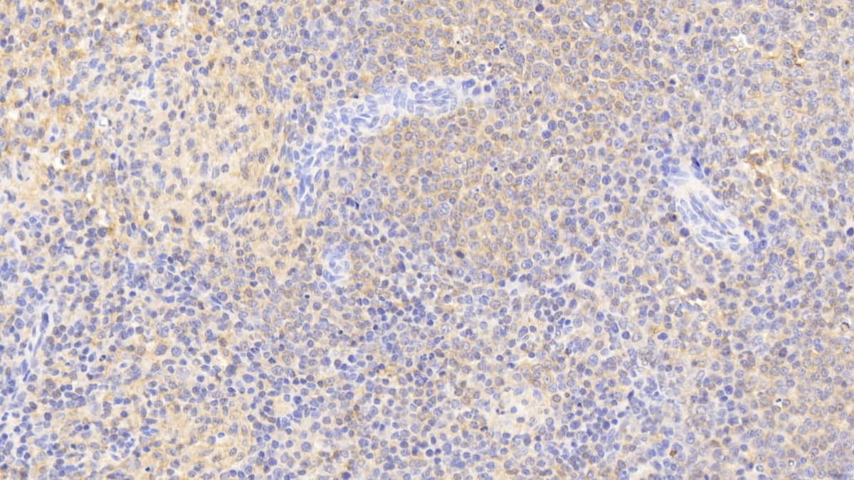 PIM3 Antibody