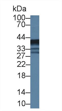 EPHX4 Antibody