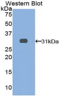 LRIG3 Antibody